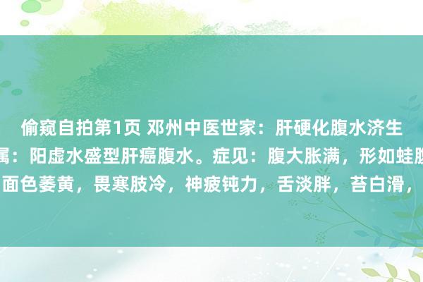 偷窥自拍第1页 邓州中医世家：肝硬化腹水济生肾气丸或附子理苓汤证属：阳虚水盛型肝癌腹水。症见：腹大胀满，形如蛙腹，按之如囊裹水，面色萎黄，畏寒肢冷，神疲钝力，舌淡胖，苔白滑，脉千里细。构成：熟地、山药、山茱萸、牛...